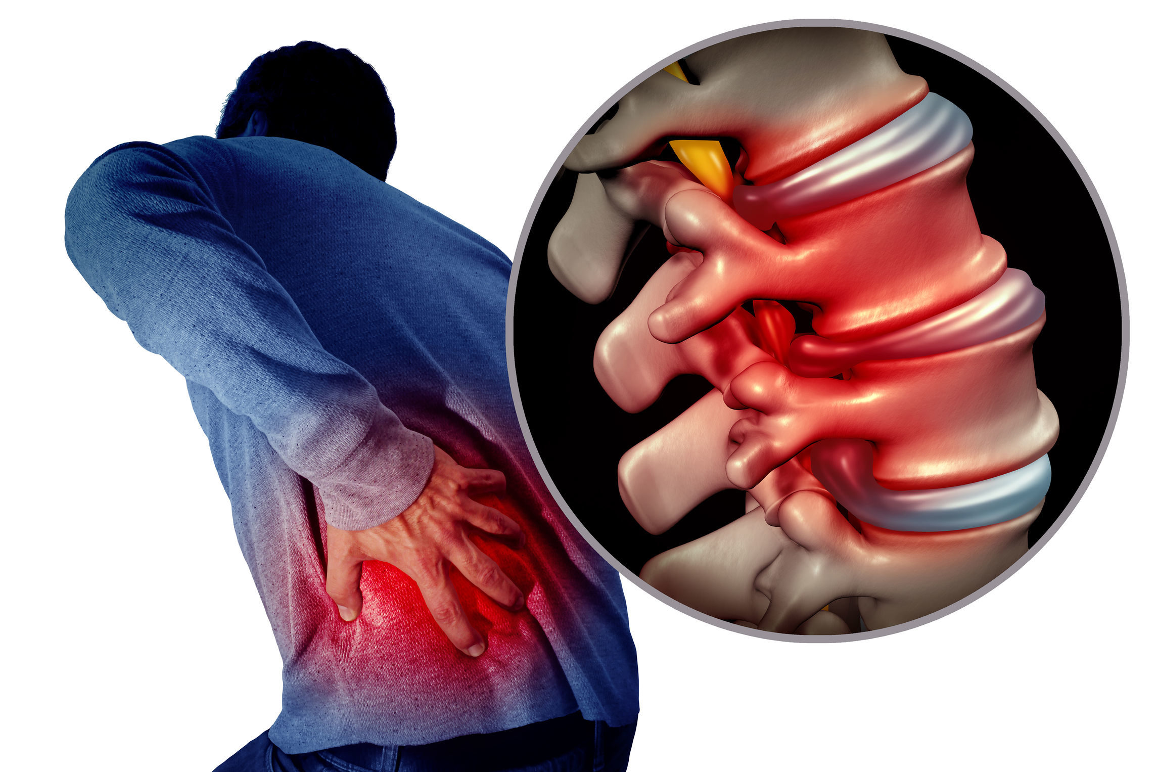 Lage rugpijn Hoe krijg je het en hoe kom je ervan af?